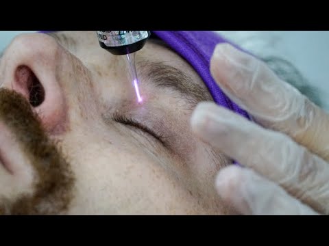 Hybrid Cold Plasma