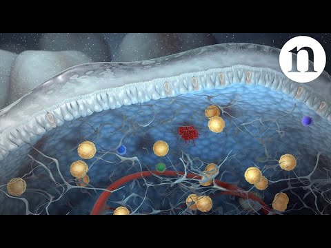 Innate lymphoid cells