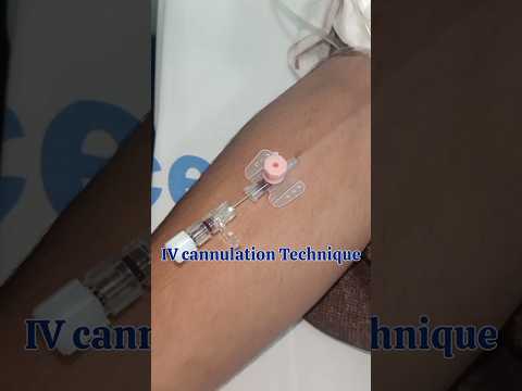 Intravenous cannula method || IV cannulation technique procedure & Practical