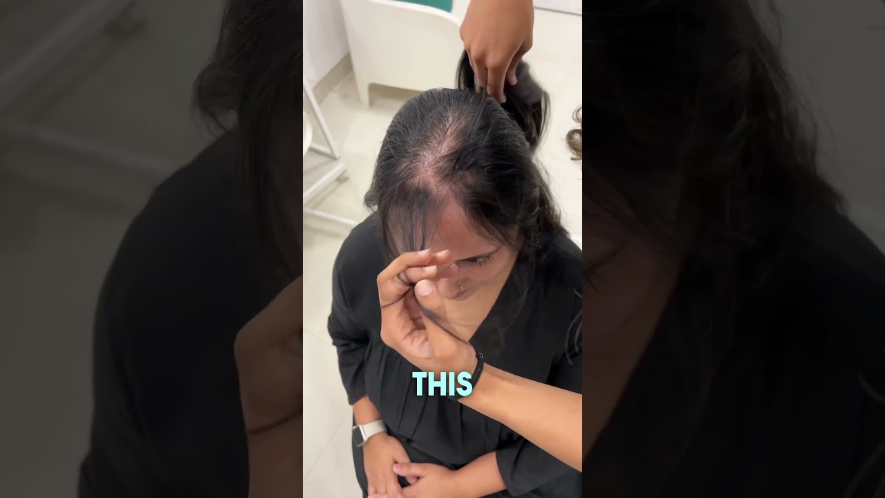 Invisible Pro Hair Patch For Hair Thinning | Hair Extension For Thinning Hair #1hairstop #shorts