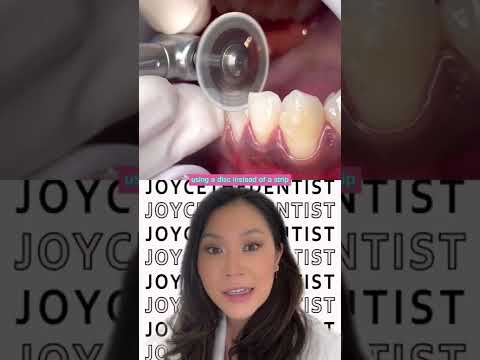 IPR (INTERPROXIMAL Reduction) using a Disc before Invisalign to create space #invisalign #shorts