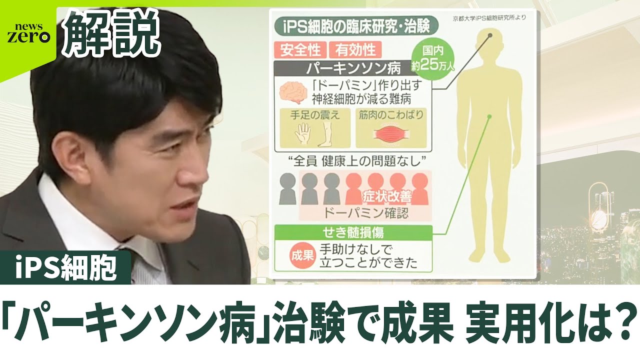 【iPS細胞で「ドーパミン」が】“パーキンソン病”にも効果  実用化は？ 患者の家族「いい光が見えた」「早く全員に」