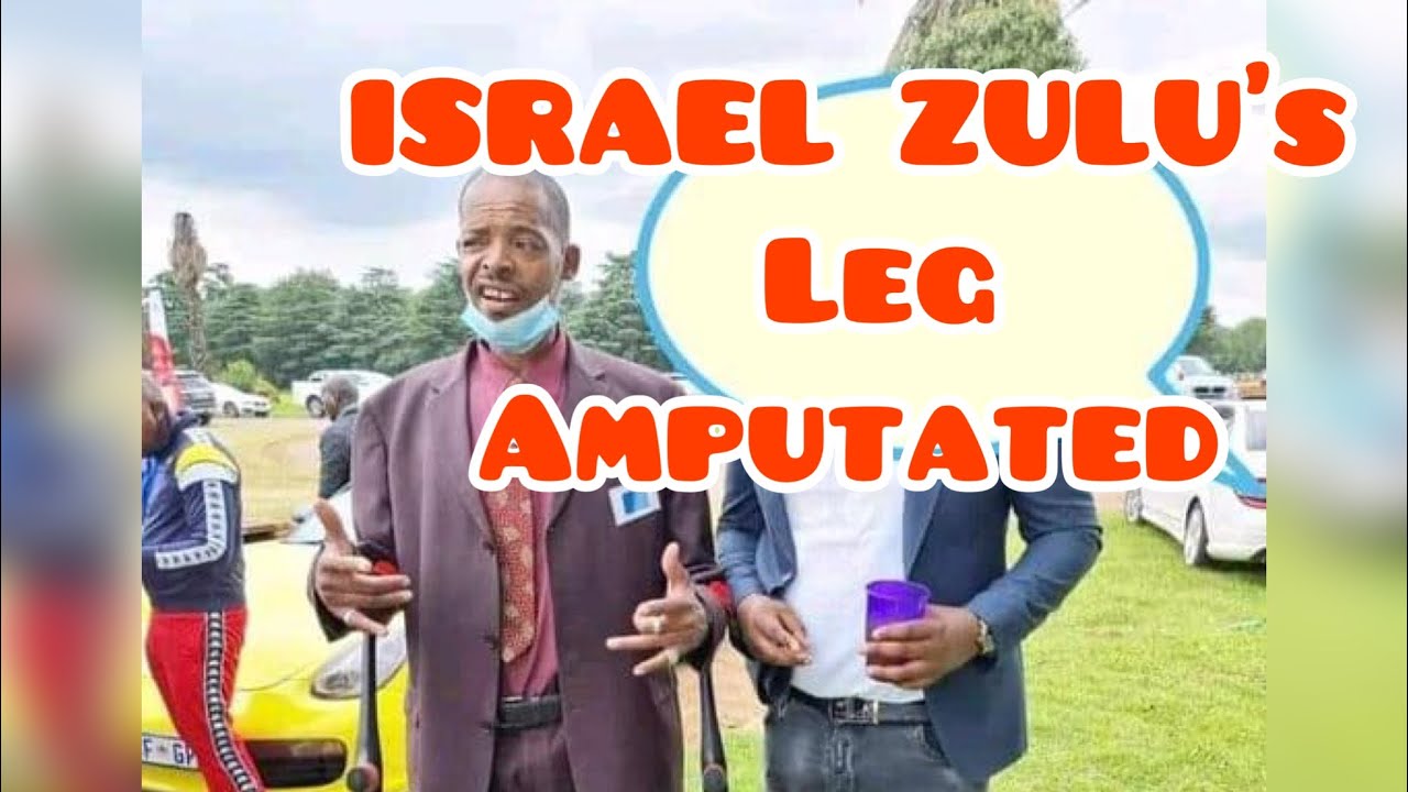 Israel Zulu’s Leg Amputated