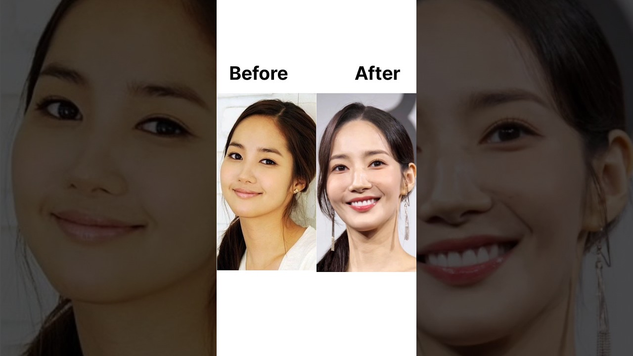 K-celebs ruined face with plastic surgery 📸✨#goviral #kpop #shorts #parkminyoung #youtube #NINNIEWON