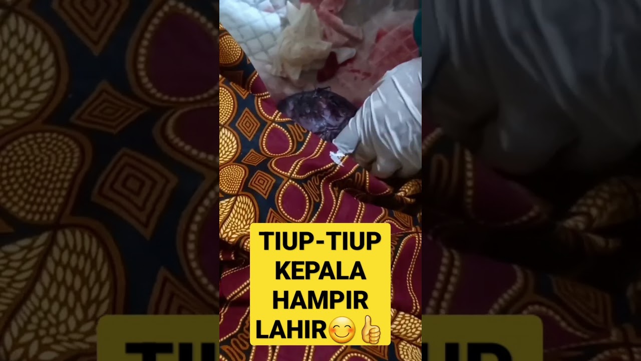 KEPALA HAMPIR LAHIR
