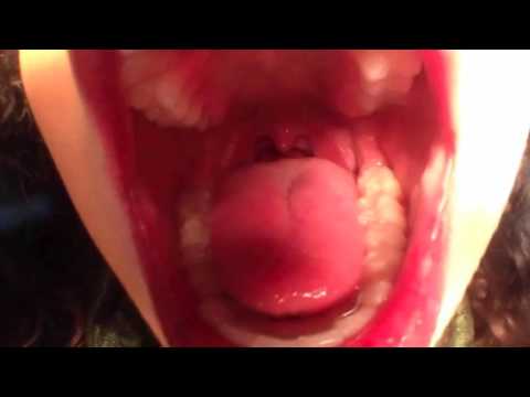 Kiss pov
