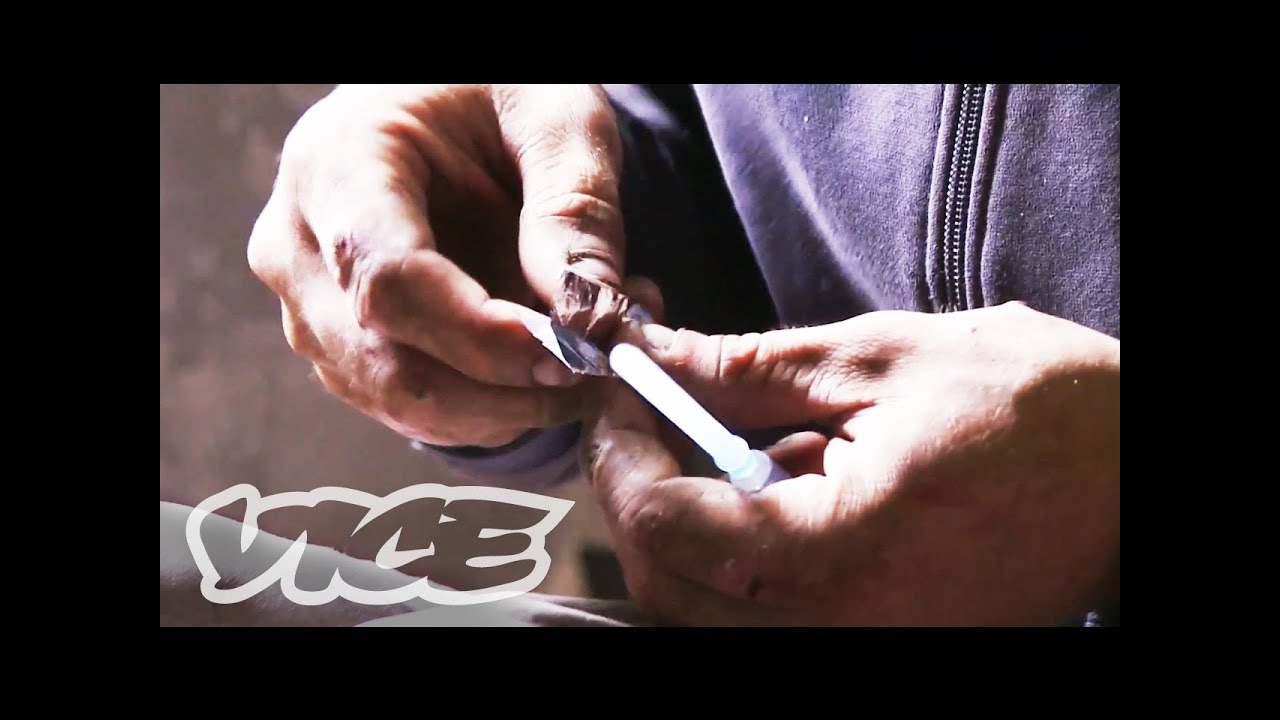 Krokodil: Russia's Deadliest Drug (NSFW)