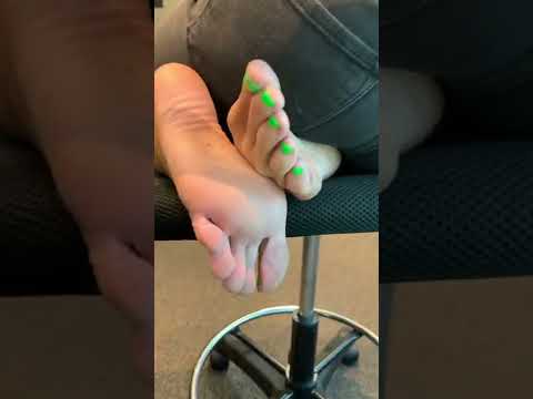 Kyle Unfug shows pretty feet 🔥🔥🔥  green nails ( Footmodel) (VIRAL FLAME AFTER DARK)