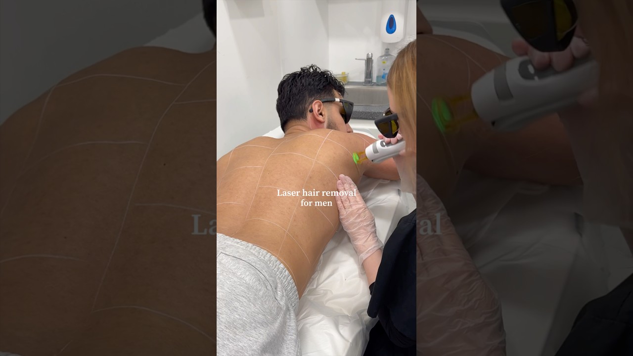 Laser hair removal for MEN?! #mensgrooming