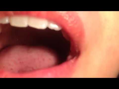 Latina girl swallowing a gummy bear