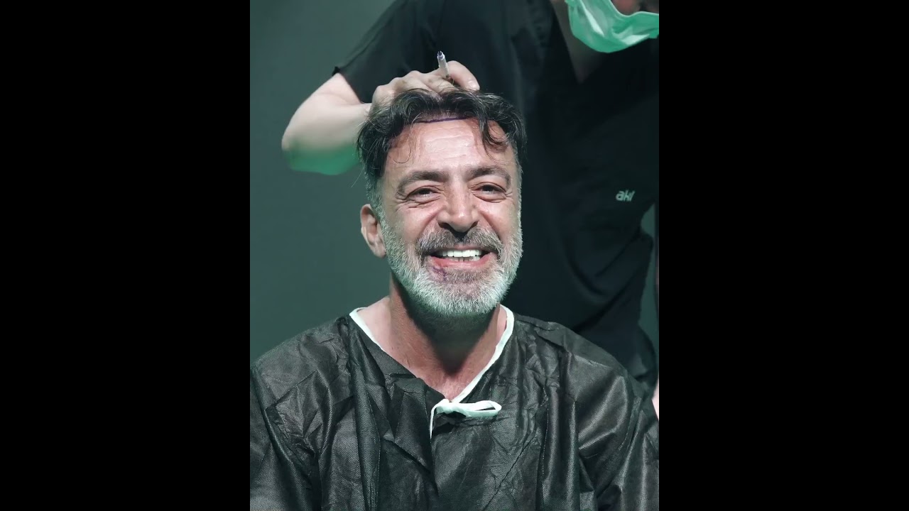 LEVENT ÜLGEN / SAÇ EKİMİ SÜRECİ / AKL KLİNİK  #hairtransplant