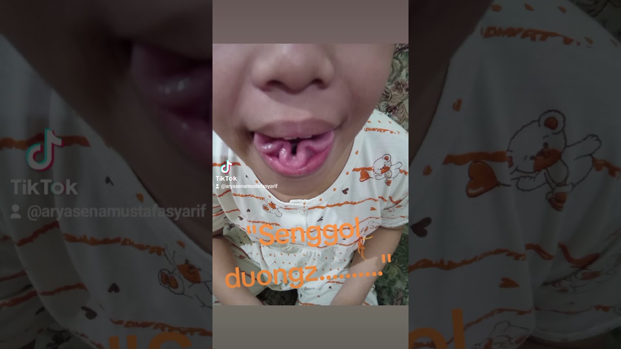 lidah mawar
