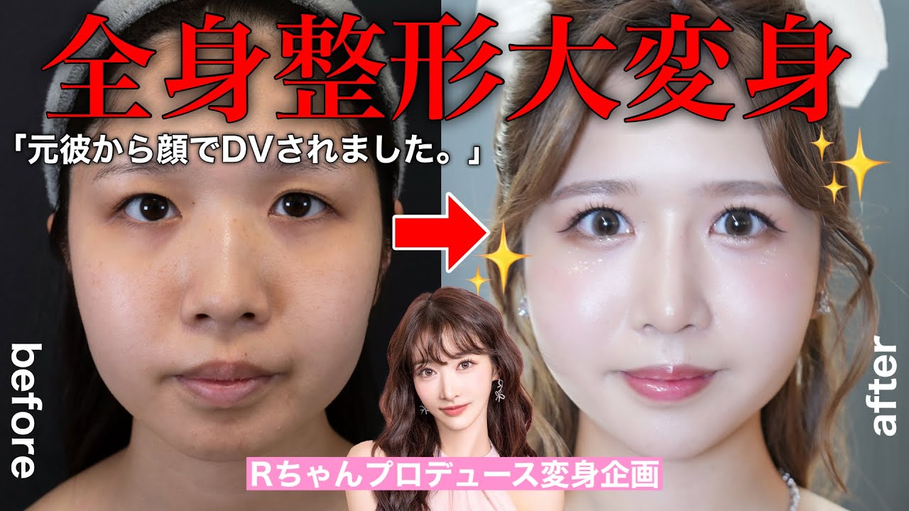 [Life-changing] Victim of domestic violence from ex-boyfriend. Full body plastic surgery! Amazing...