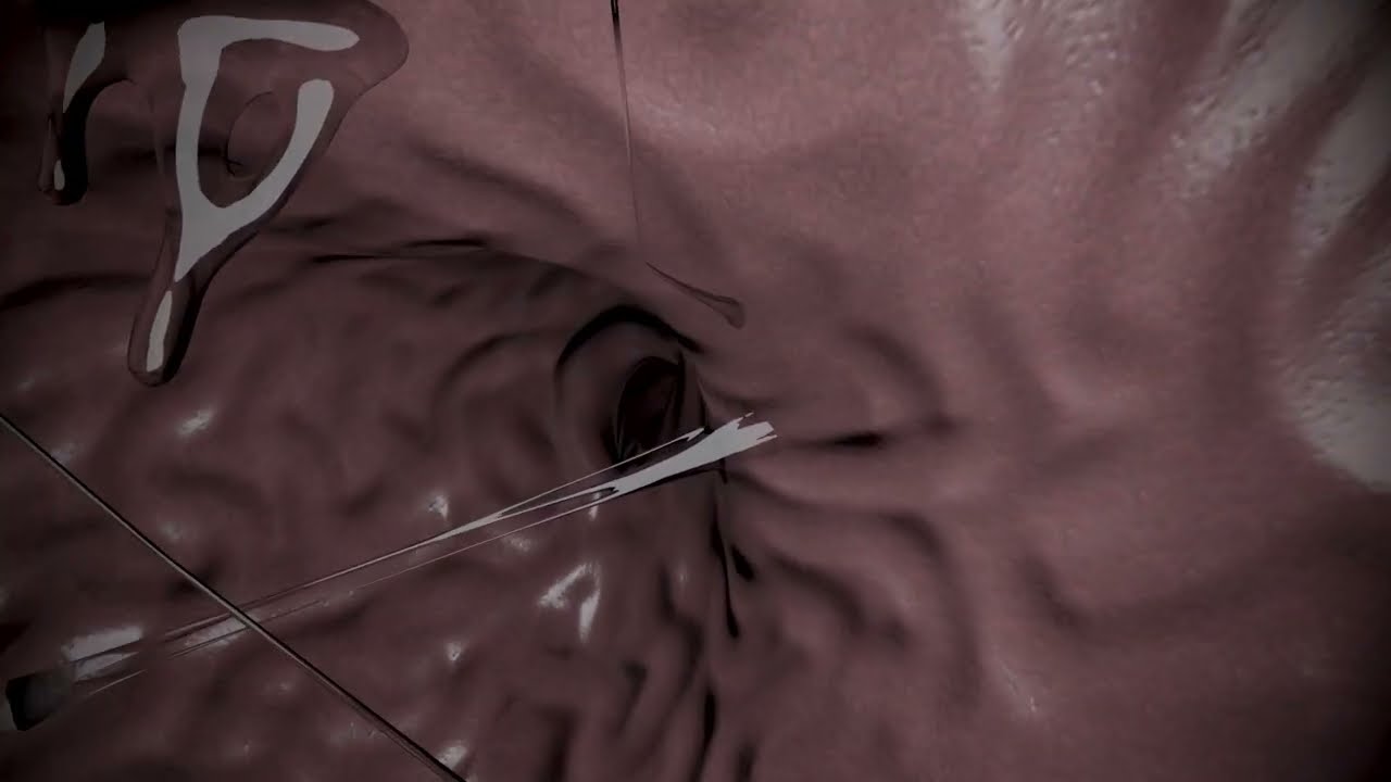 Loona Endo inspection