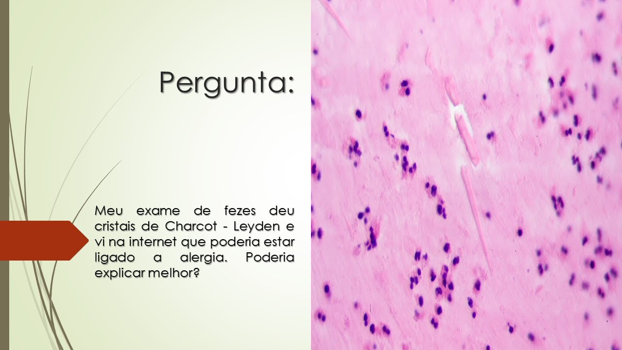 Meu exame de fezes deu cristais de Charcot-Leyden | Pode estar ligado a alergia?
