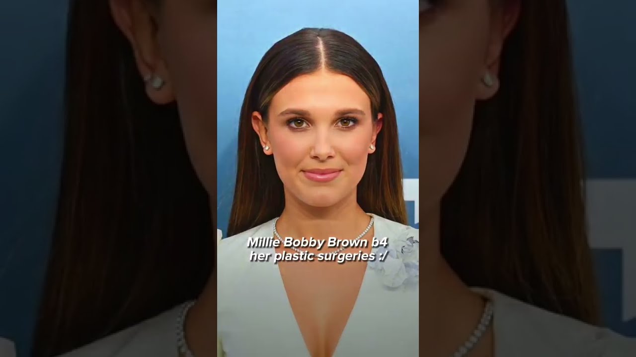 Millie Bobby Brown  before her plastic surgeries