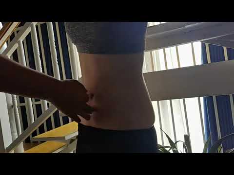 Navel piercedNavel acupuncture