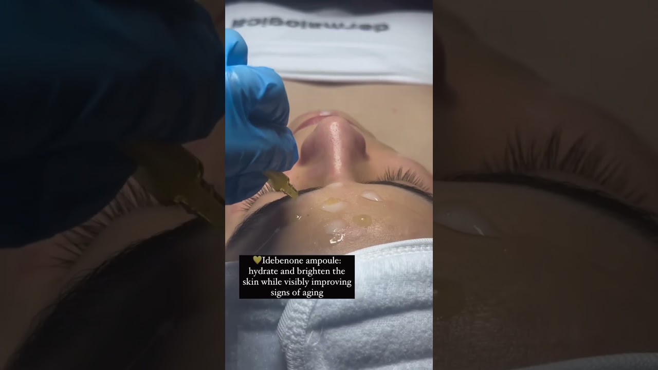 Newest Korean Skincare Treatment 2024 #skincaretips #koreanskincare #bbglow