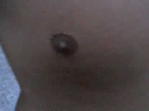 NIP TWIST