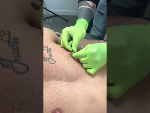 Nipple piercing
