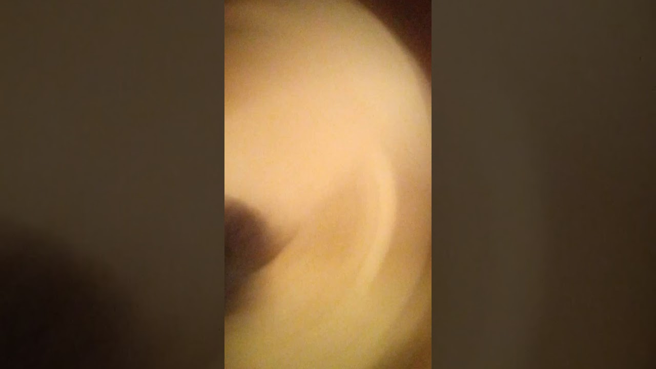 Nipples