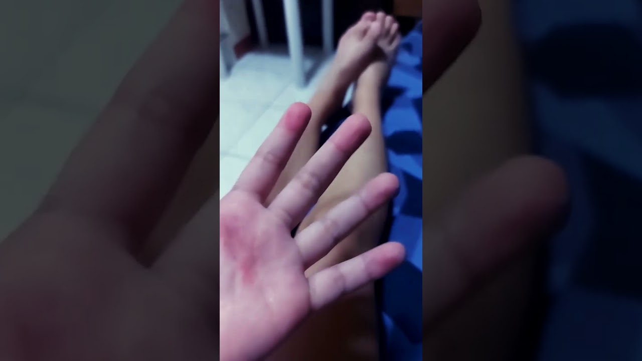 OMG  I have cancer 😭😭