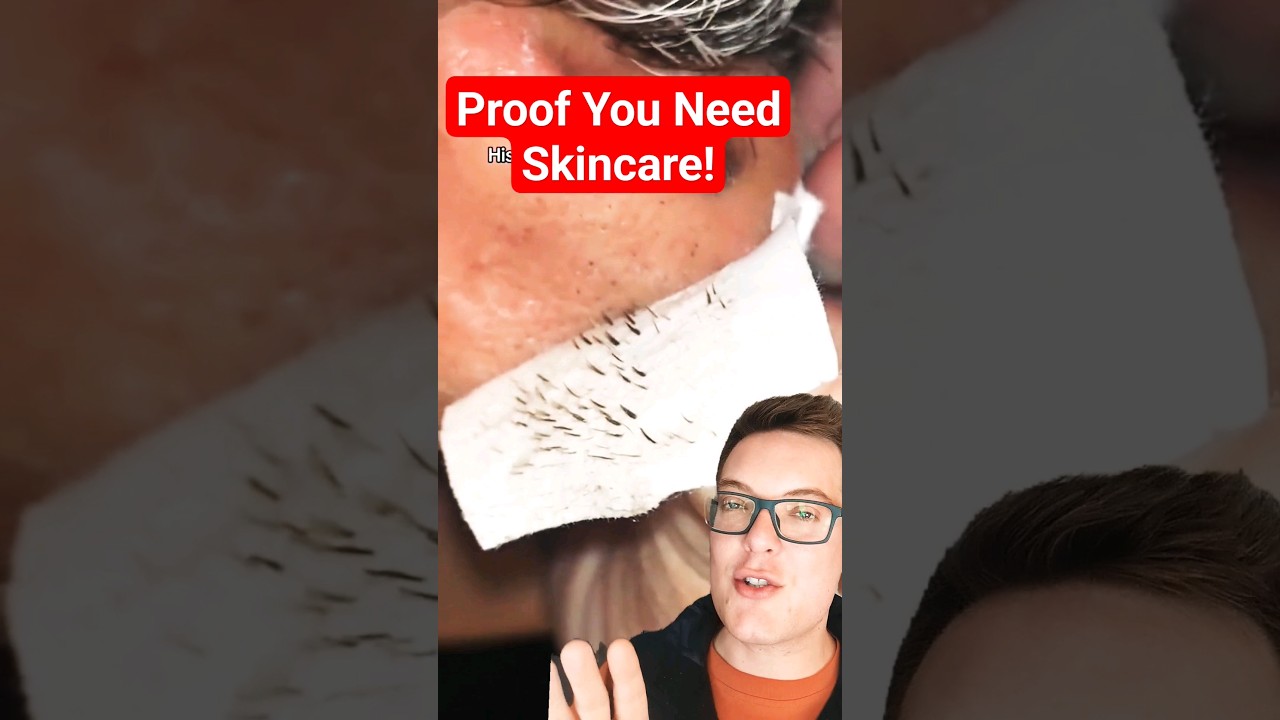 PROOF YOU NEED SKINCARE - Shocking Pore Strip Removal #shorts