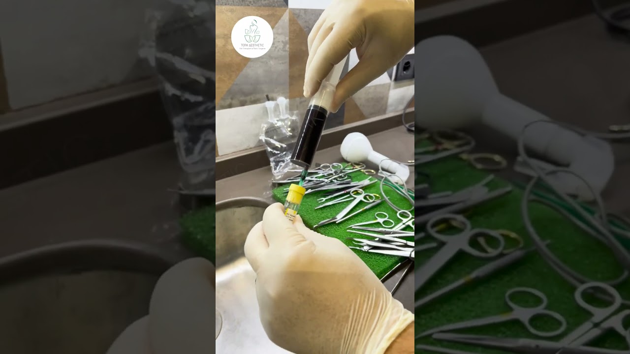 PRP treatment for skin #shorts #prp