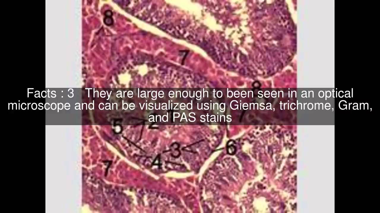 Reinke crystals Top  #5 Facts