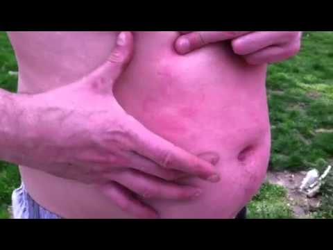 Retard belly punch show down pt.2