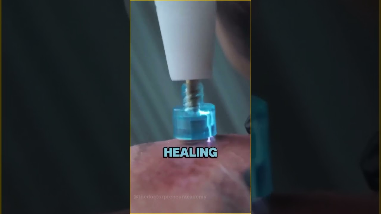 Revolutionary Cold Plasma Therapy: The Future of Skin Healing & Wound Care!