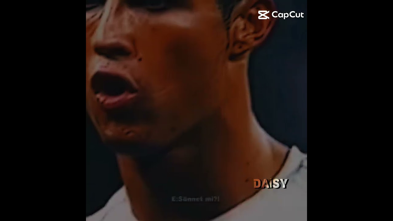 Ronaldo Sünnet Ediyo #keşfetol #video #trending #sünnet