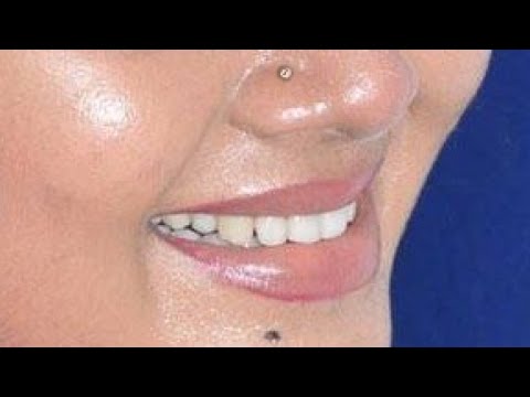 Saranya Unseen Closeup || Malayalam Actress