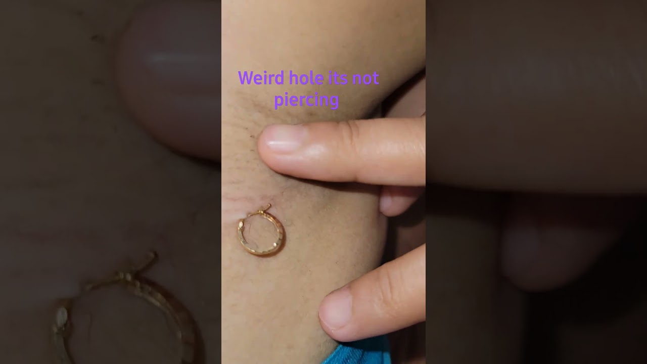 Since Birth #weird #armpit #hole #shortvideo #viral #trendingshorts