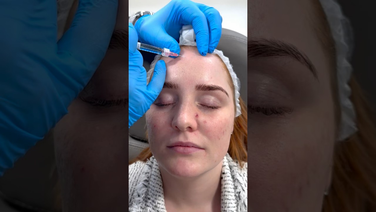 Skin booster treatment at Dr. Medispa