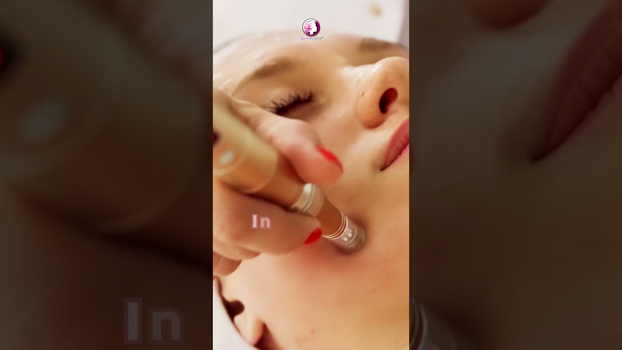 Skin Place BB Glow Treatment #shorts #BBGlowTreatment #bbglow