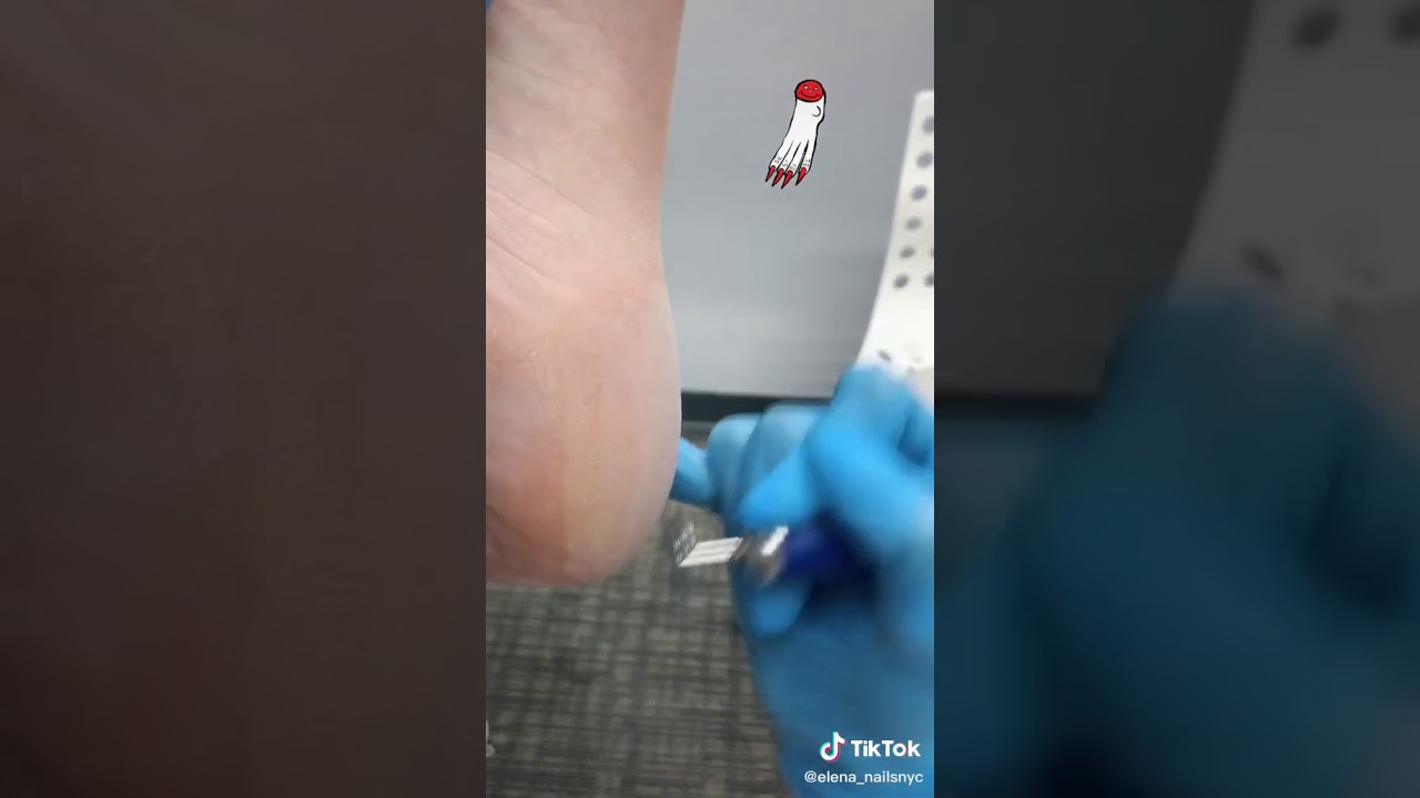 Smart Pedicure for Foot