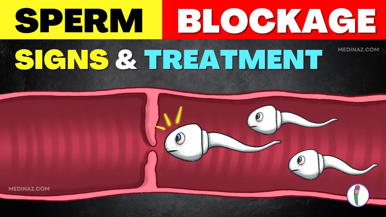 Sperm Blockage - Causes, Symptoms, and Effective Treatments | Male Infertility Treatment | Low Sperm
