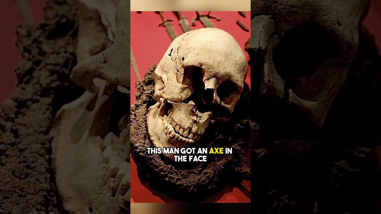 The Brutal Remains Found After a Medieval Battle