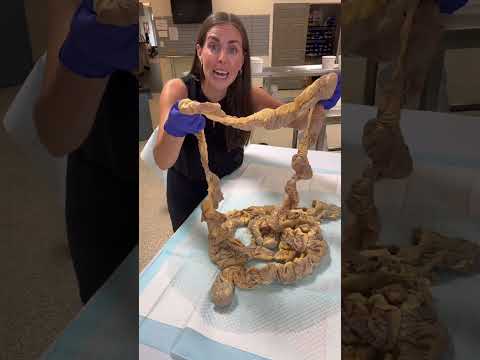 The digestive system is amazing! #anatomy #humanbody #science #stem  #intestines #digestivesystem