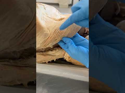 The Layers of the Human Abdomen