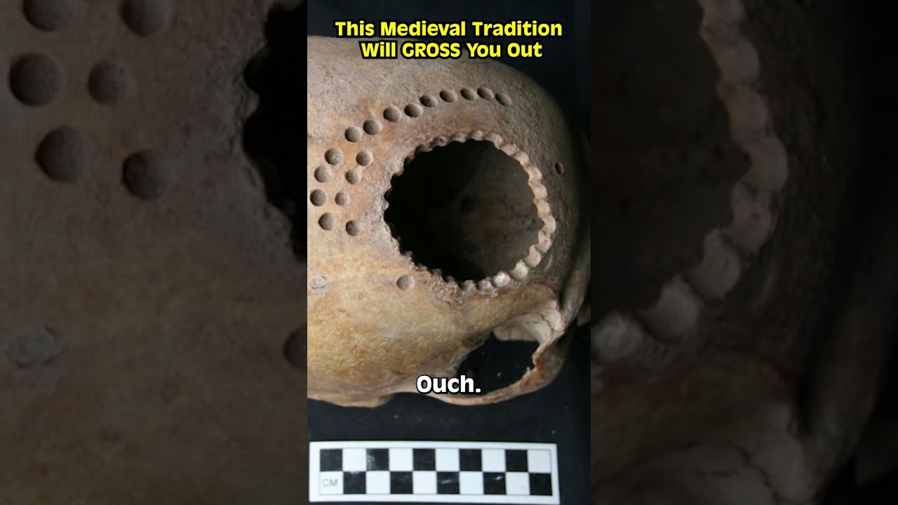 This Medieval Tradition Will GROSS You Out #Shorts