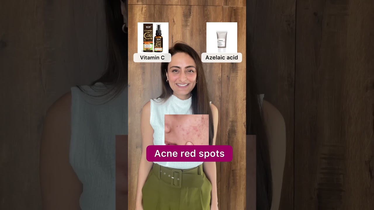 This or that | open pores, dark spots, blackheads, whiteheads
