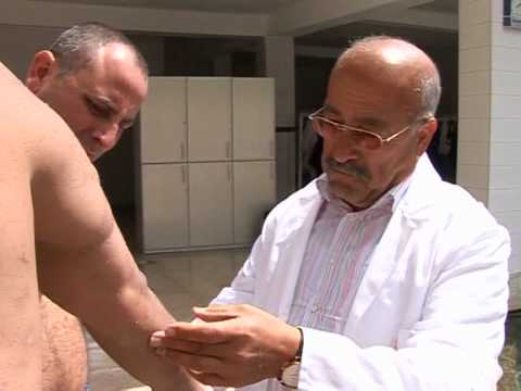 Turkish flesh eating fish relieve skin disease