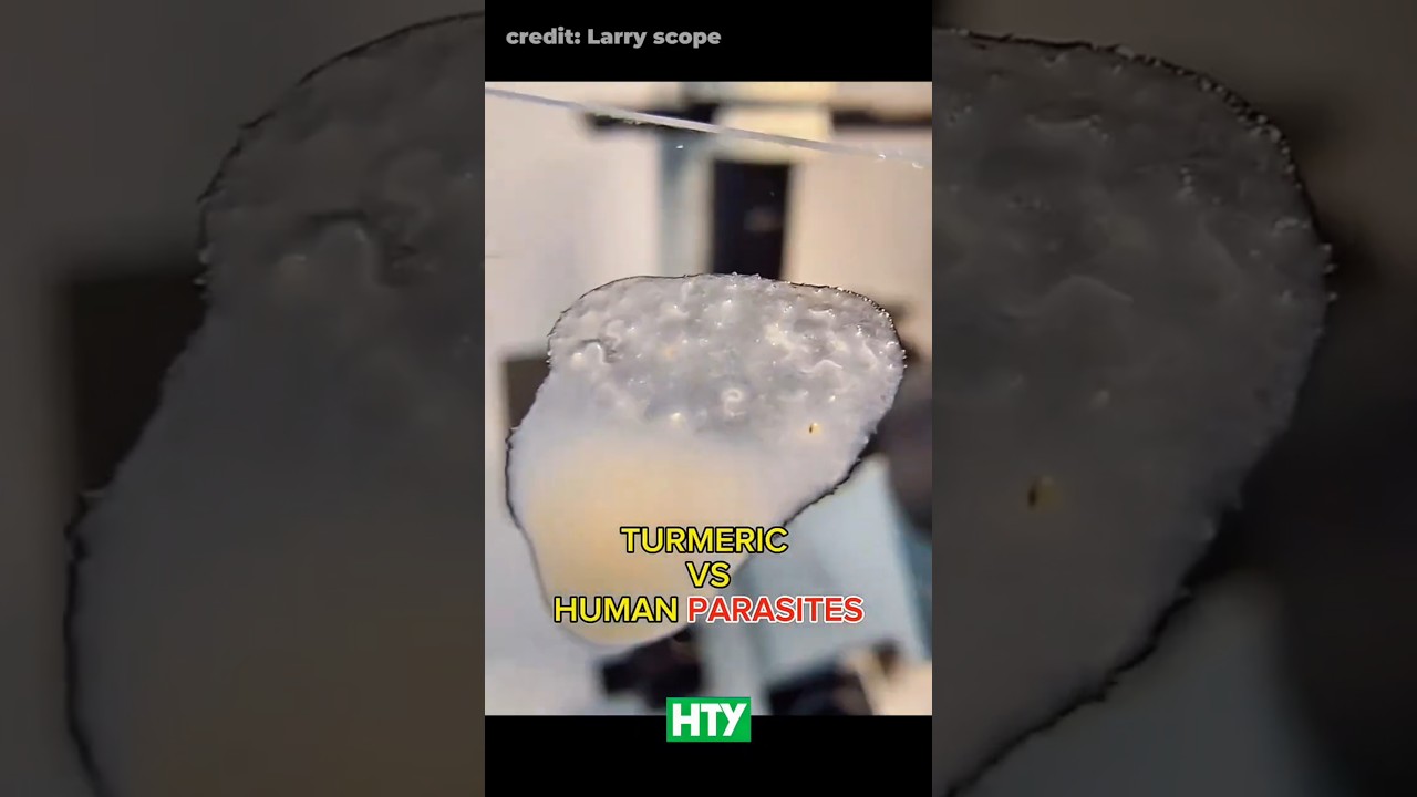 Turmeric vs. Parasitic Worms - You Won’t Believe This 🫚🔬