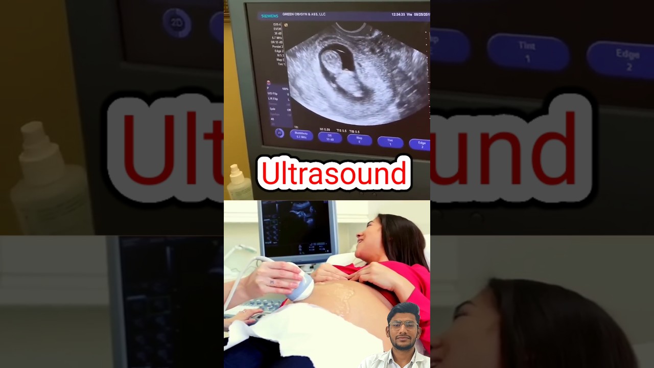 Ultrasound / Sonography 😱                   #pregnancy #ultrasound #sonography #baby #babyshorts