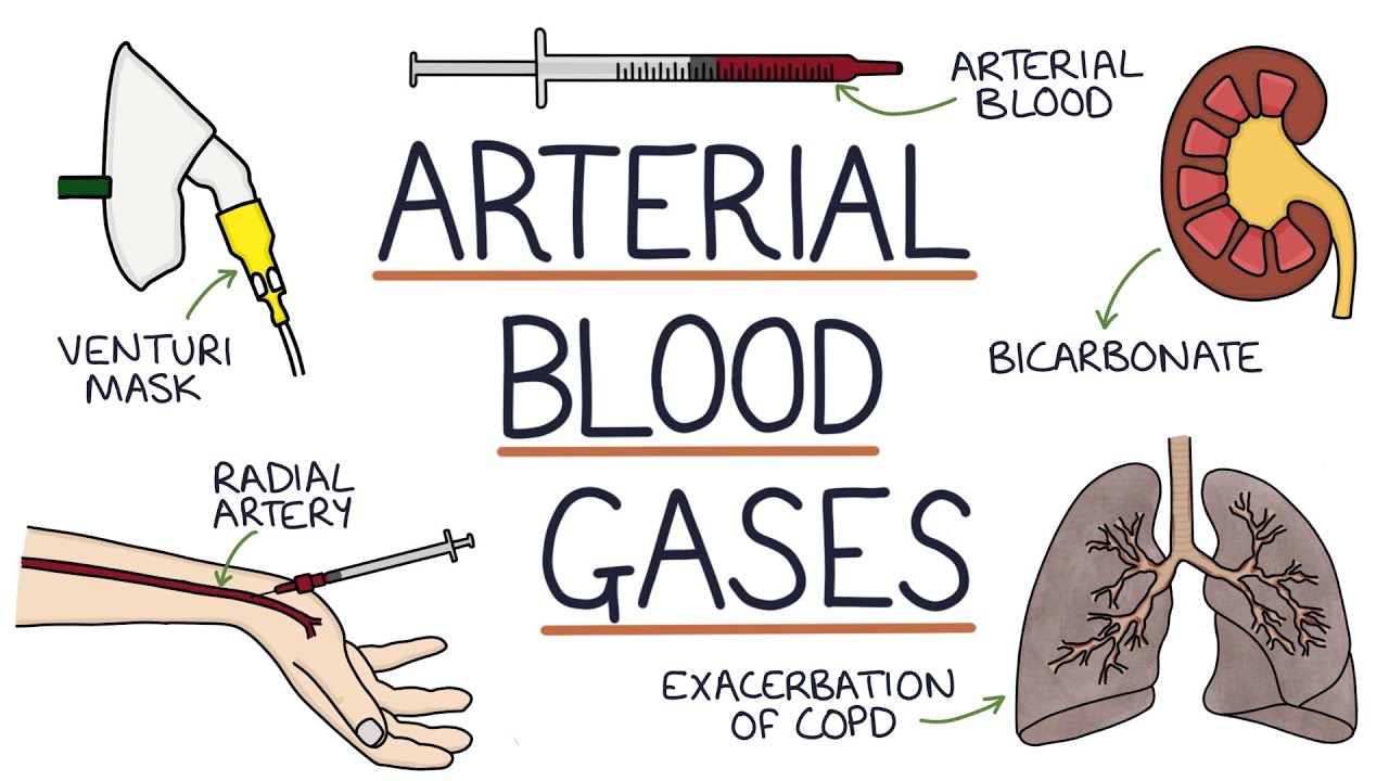 Understanding Arterial Blood Gases