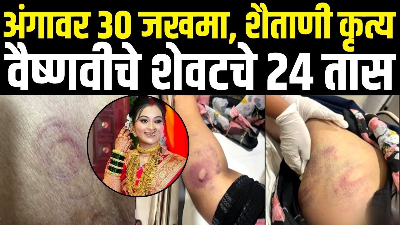 Vaishanavi Hagawane Case Breaking | अंगावर ३० जखमा, शैताणी कृत्य, वैष्णवीचे शेवटचे २४ तास