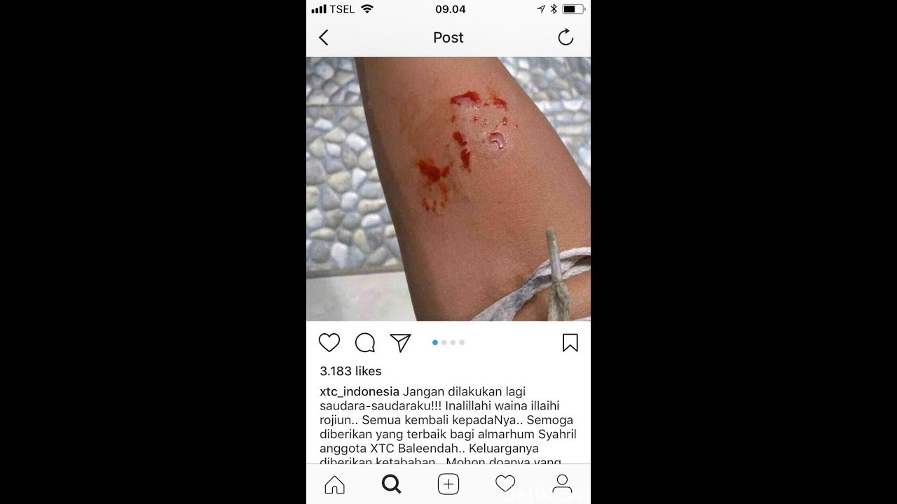 Viral, ABG di Bandung Tewas Dipatuk Ular King Kobra Peliharaannya