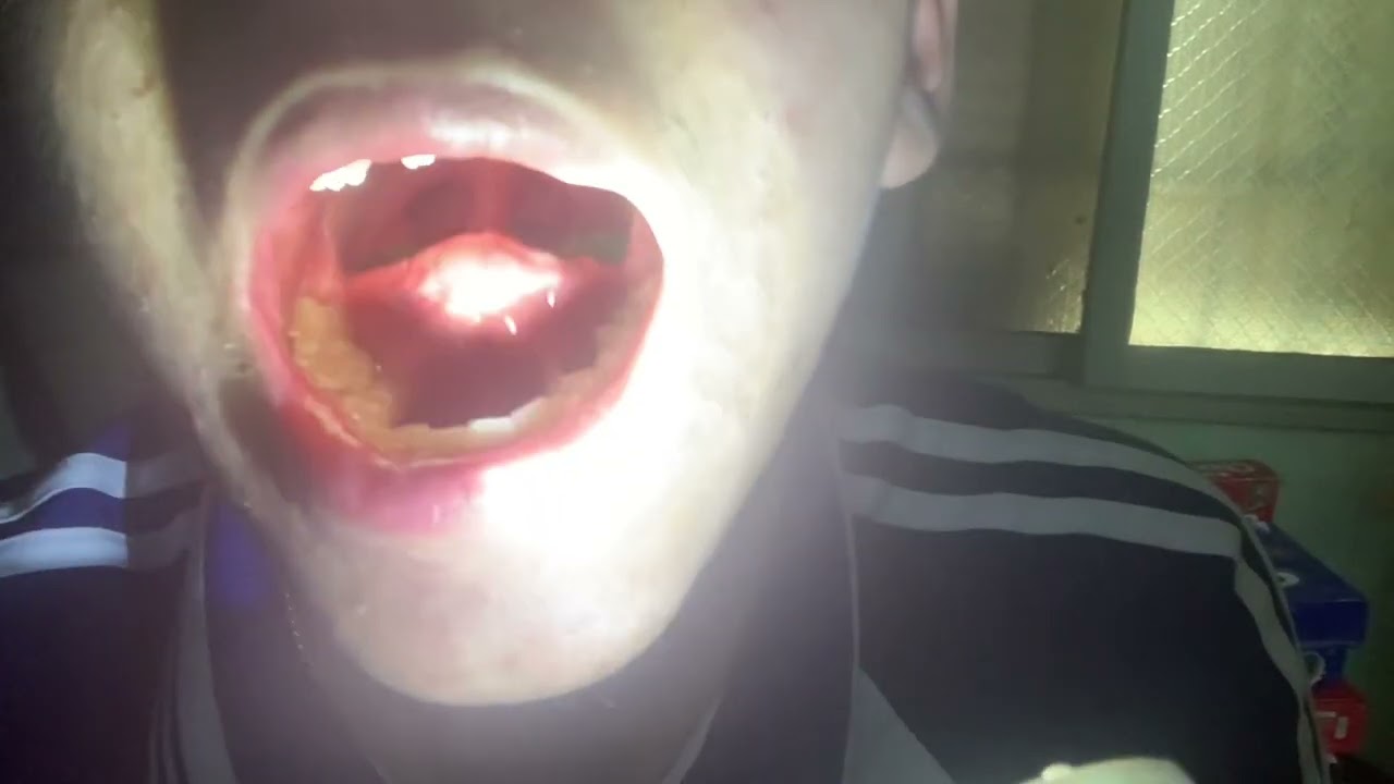 Vore video ( swallow a star gummy )